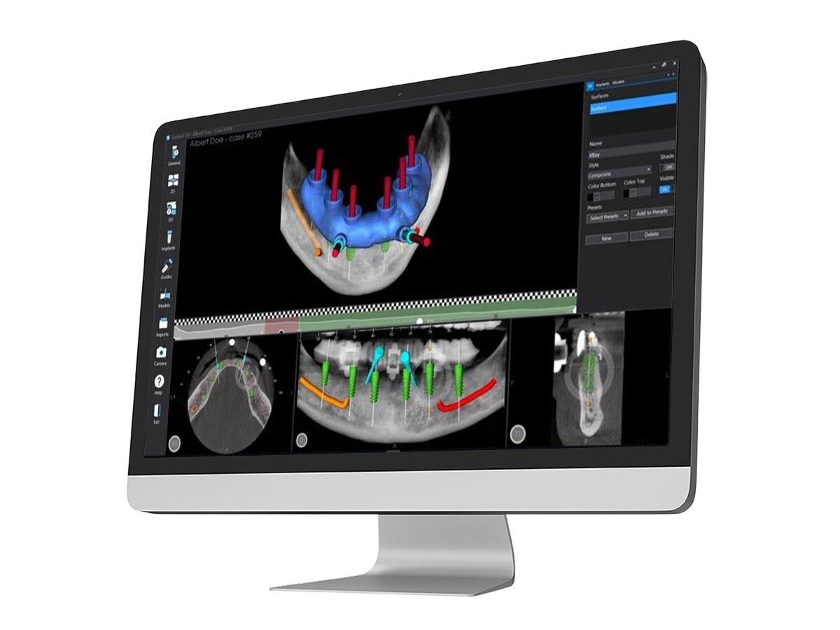 implantologia 3d studio fossali